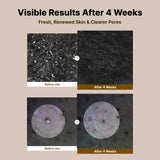 NIDA Black Rice Blackhead Exfoliating Serum