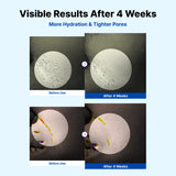 NIDA Youthful Formula™ Ultieme Hydraterende Crème
