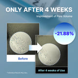 Crema idratante definitiva NIDA Youthful Formula™