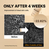 NIDA White Rice Whitehead Exfoliating Serum